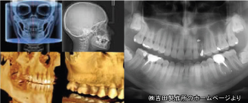 �g���t�B�[�p���v���X